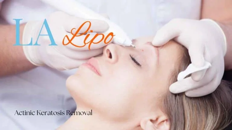 Woman receiving Actinic Keratosis Removal Treatment Hendon