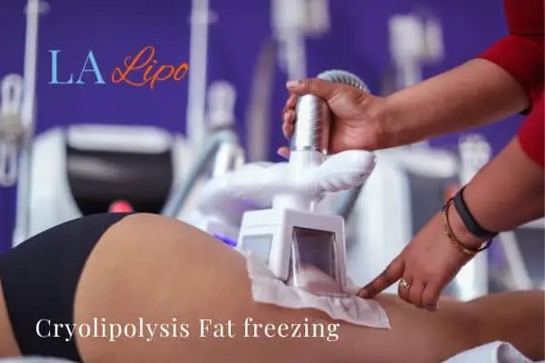 women getting fat freezing Hendon