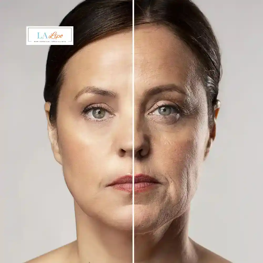 How Can You Tell If Non-Surgical Skin Tightening Is Right for You Hendon?