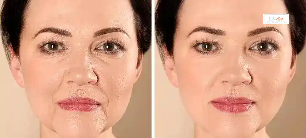 Why Aren’t My Skincare Products Making My Sagging Skin Look Firmer Hendon?
